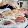 Bebé recién nacido en incubadora