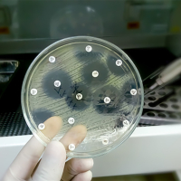 Pruebas de resistencia bacteriana a los antibióticos en una placa de Petri