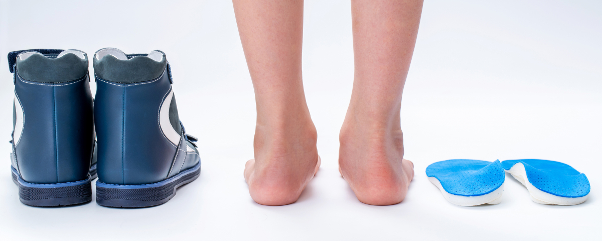 Calzado, pies planos de un niño y plantillas ortopédicas